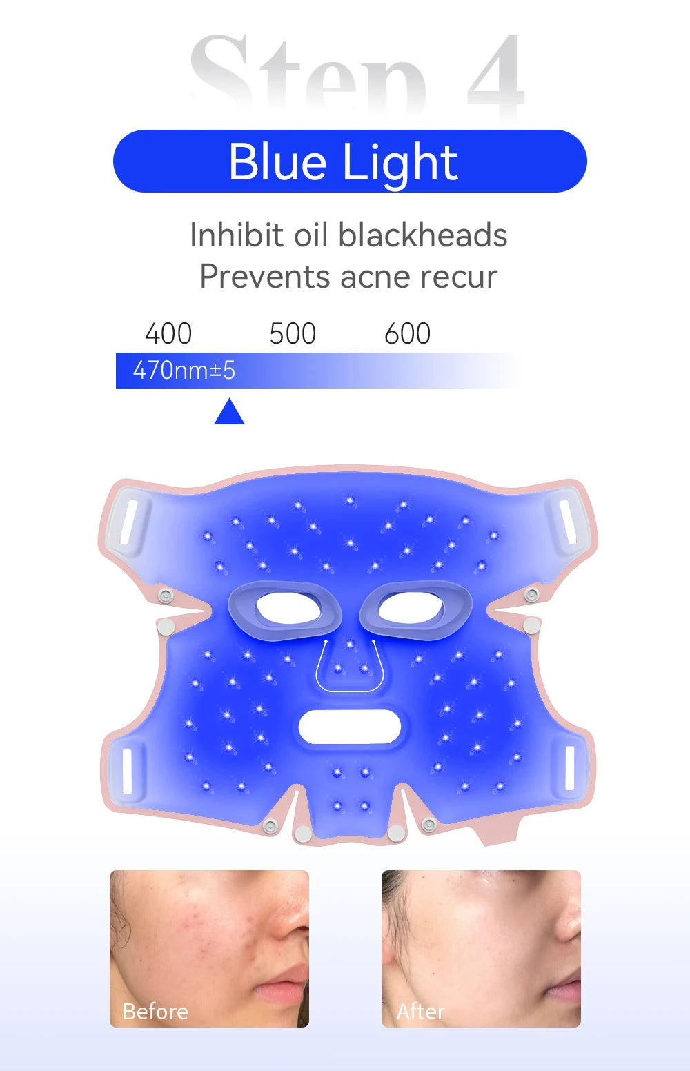 ANLAN LED Gesichtsmaske – 5 Farben für strahlend schöne Haut ✨