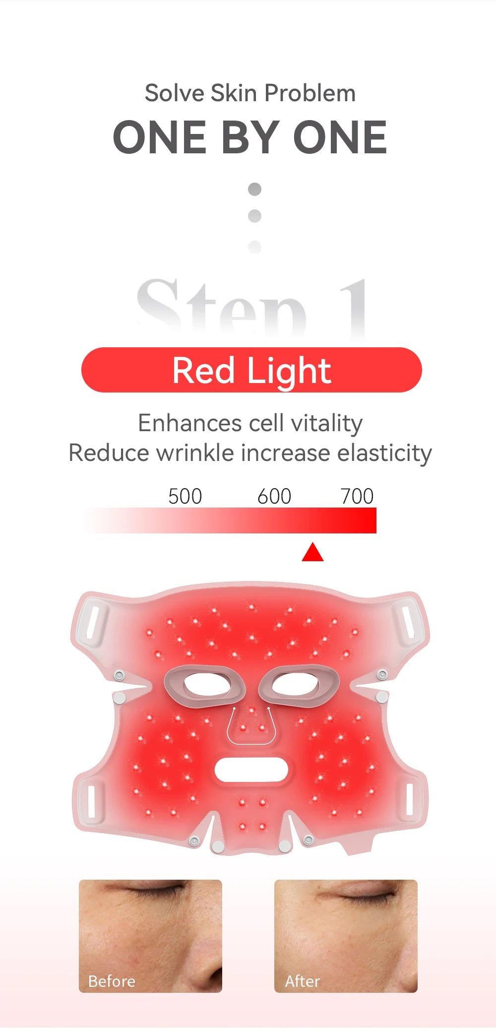 ANLAN LED Gesichtsmaske – 5 Farben für strahlend schöne Haut ✨
