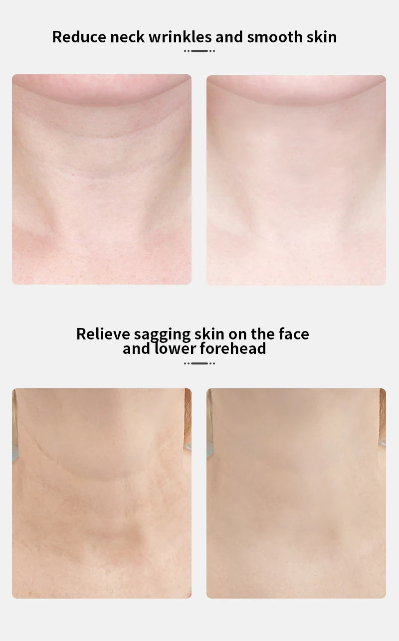 ANLAN EMS Face & Neck Device – Contouring trifft Technologie