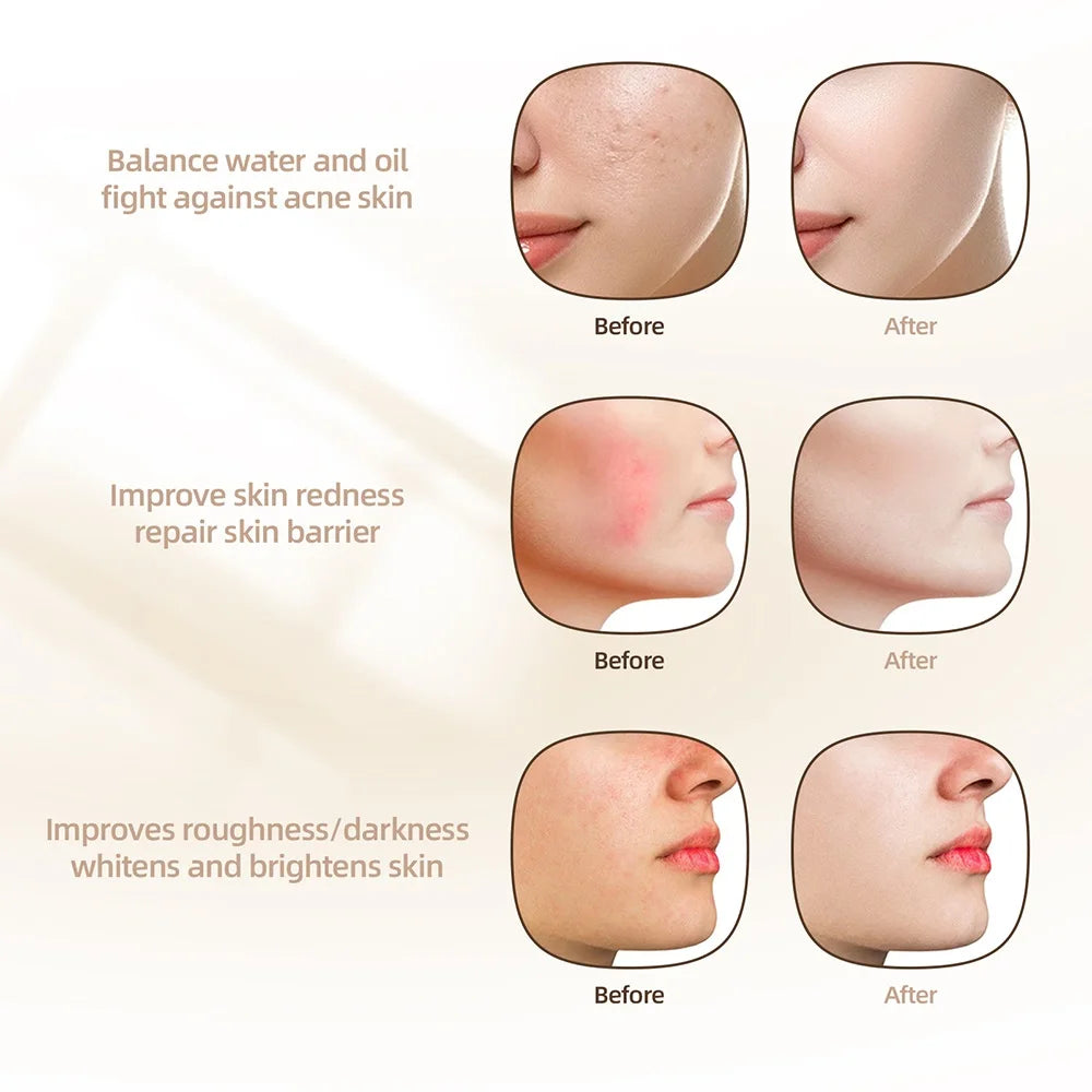 7-Farben Photon Silikon LED-Gesichtsmaske – Kabellose Rotlichttherapie für Hautpflege & Anti-Aging