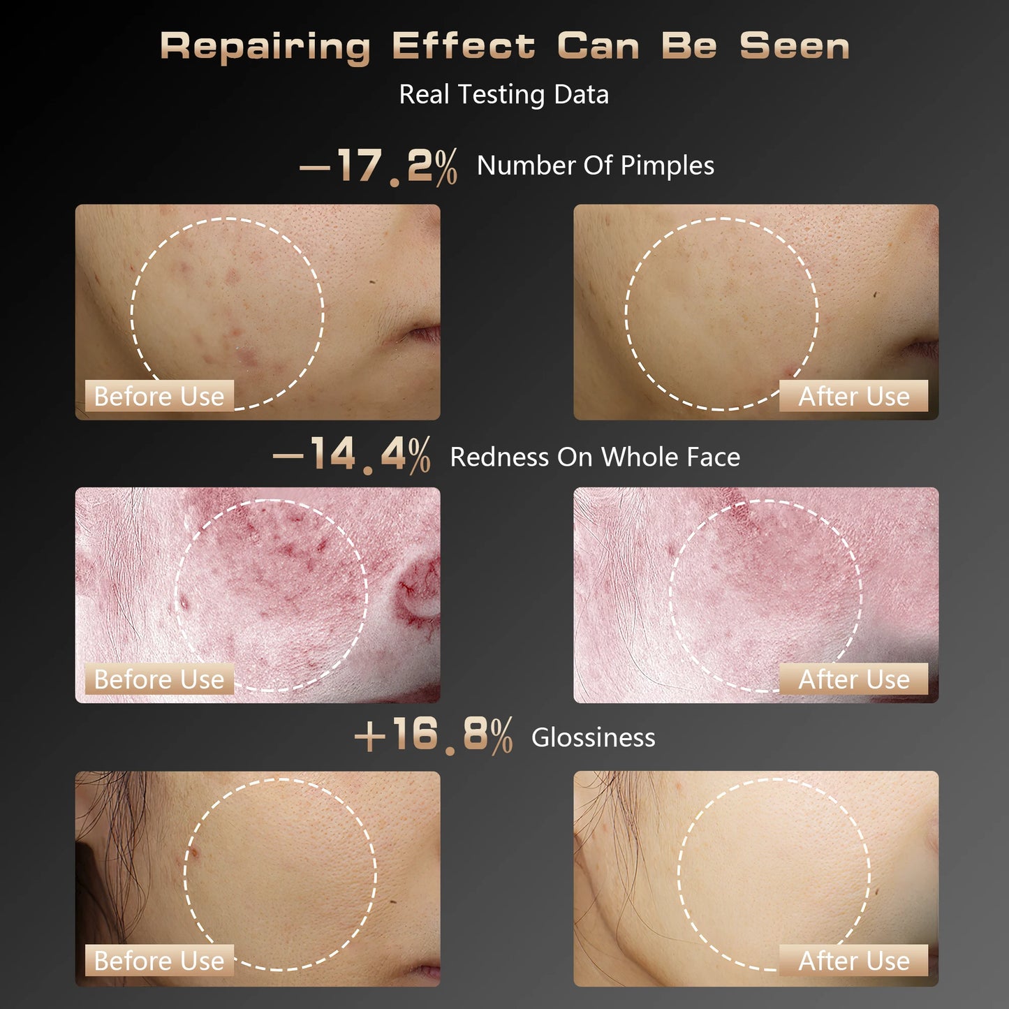 LED Gesichtsmaske für strahlende Haut & jugendlichen Glow 💡