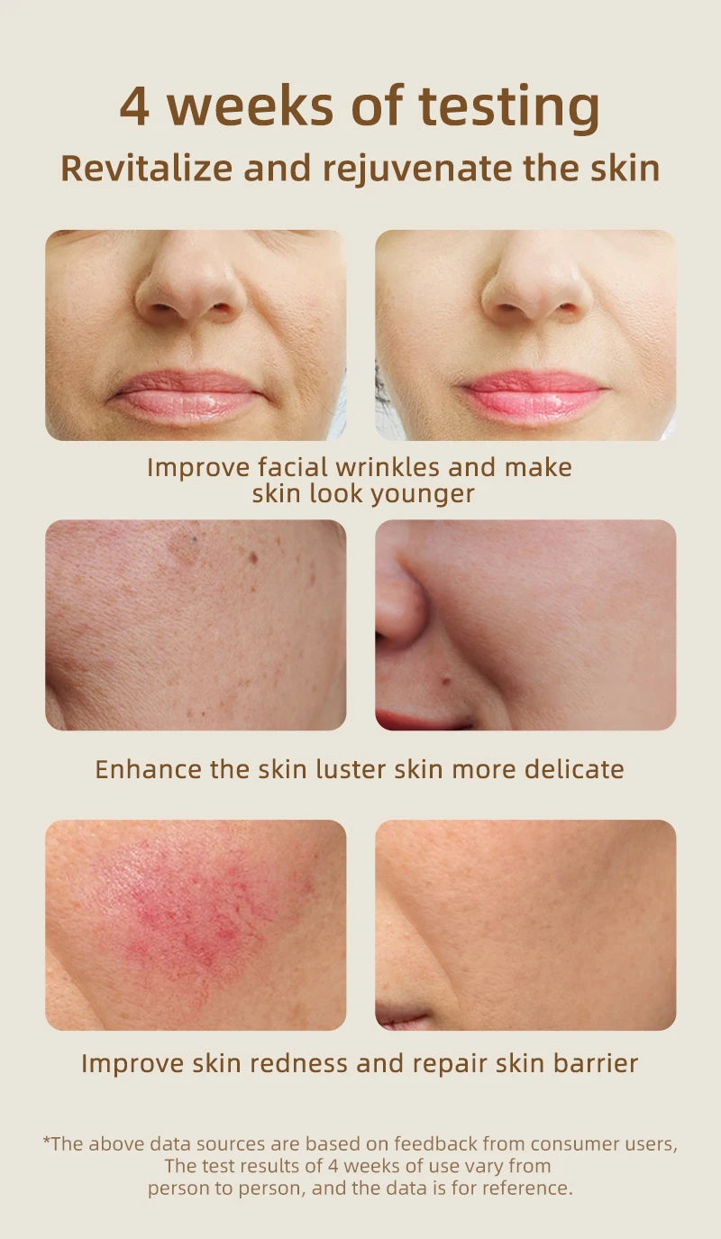 4-in-1 Rote LED-Lichttherapie Maske – Flexible Silikonmaske für Hautverjüngung & Anti-Aging