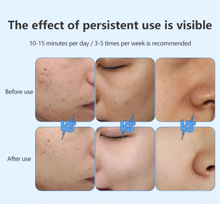 LED-Gesichtsmaske mit Halsabdeckung – Professionelle Lichttherapie für strahlende Haut