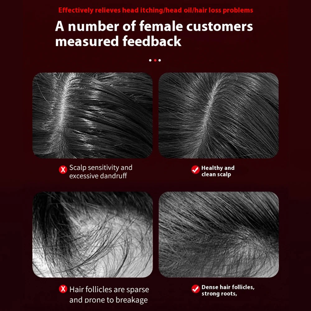 Elektrische Haarwuchsbürste mit Infrarotlicht – Deine Power-Kur für volles, gesundes Haar! ✨