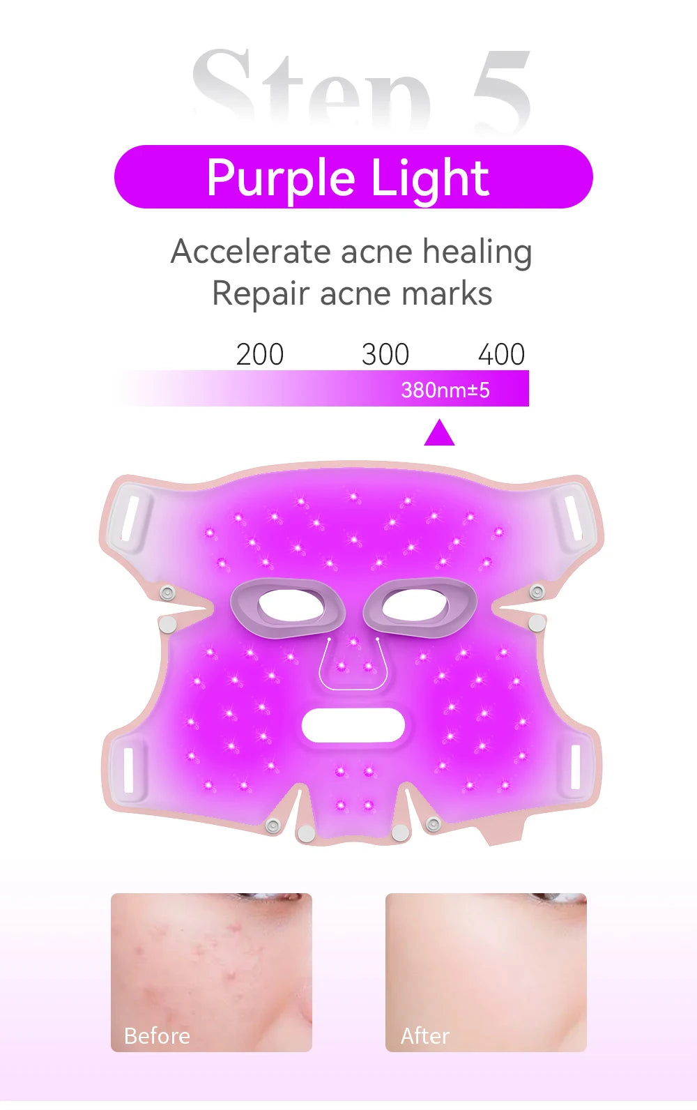 ANLAN LED Gesichtsmaske – 5 Farben für strahlend schöne Haut ✨