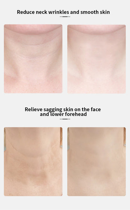 ANLAN EMS Face & Neck Device – Contouring trifft Technologie