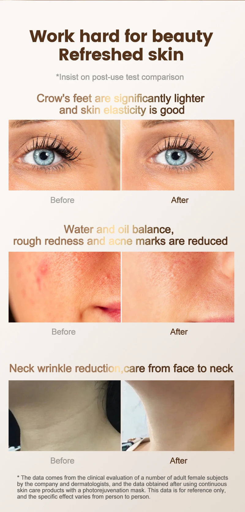 VanCostar Premium LED-Gesichtsmaske mit 807 LEDs & Rotlicht-Therapie – Dein persönliches Luxus-Spa zuhause! ✨