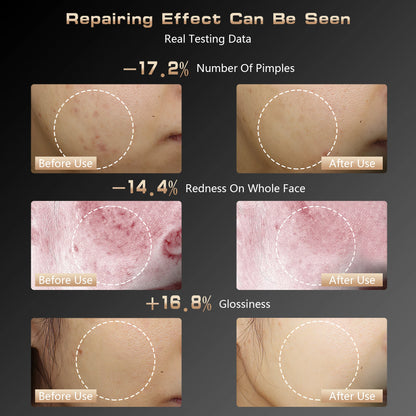 LED Gesichtsmaske für strahlende Haut & jugendlichen Glow 💡