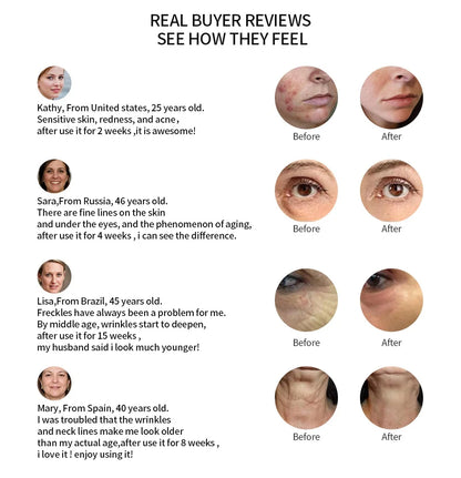 EMS & LED Photon Beauty Gerät – Für straffe Haut und strahlenden Teint