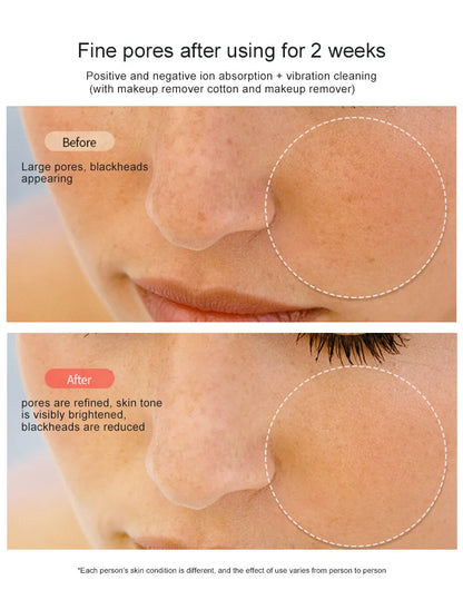 RF & EMS Beauty-Gerät – Dein Home-Lifting für straffe, jugendliche Haut! ✨